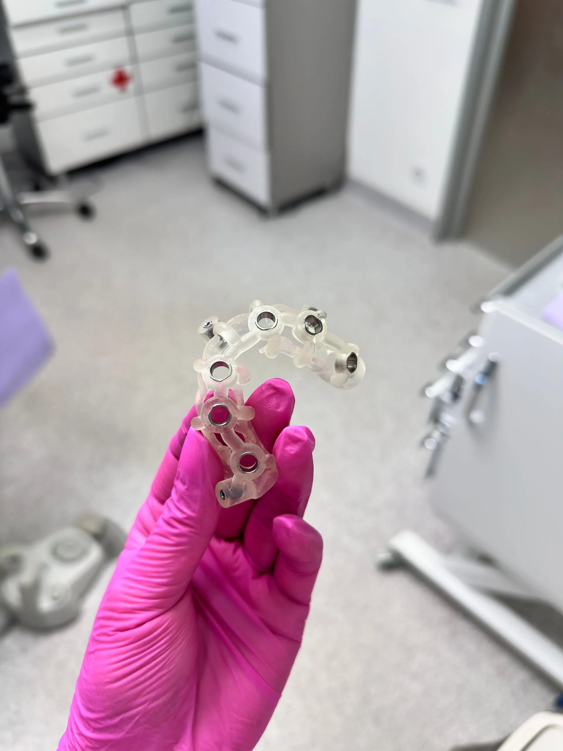 Modelo de implante dental de titanio usado para explicar el tratamiento al paciente